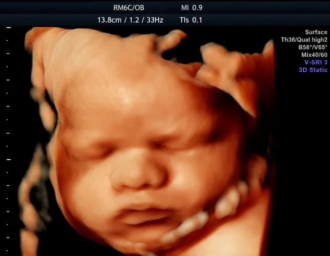 Clínica Isace. Servicios medicina materno-fetal