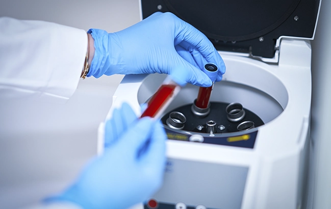 Clinica Isace. Medicina regenerativa íntima con Plasma Rico en Plaquetas (PRP)​